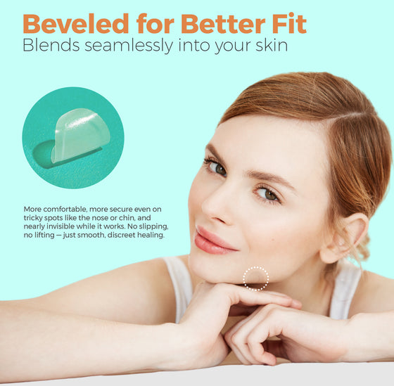 Halo Spot Patch – Invisible Acne Dots (53 Patches)