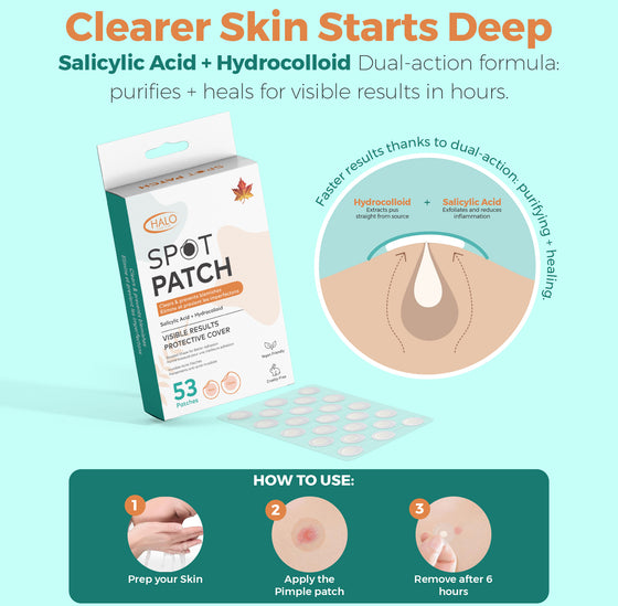 Halo Spot Patch – Invisible Acne Dots (53 Patches)