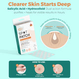 Halo Spot Patch – Invisible Acne Dots (53 Patches)